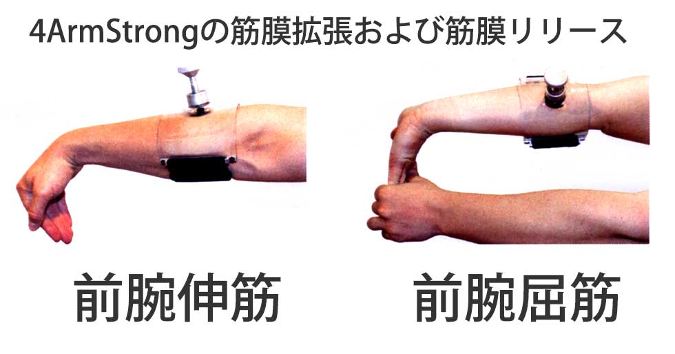 腕上がり防止デバイス 4Arm Strong (フォーアーム ストロング) 日本語 